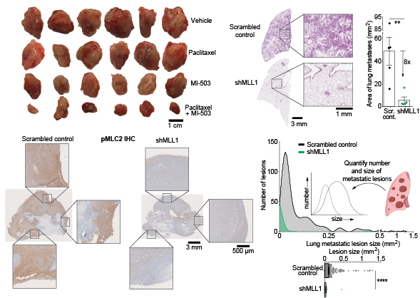 Epigenetics Cancer Progression