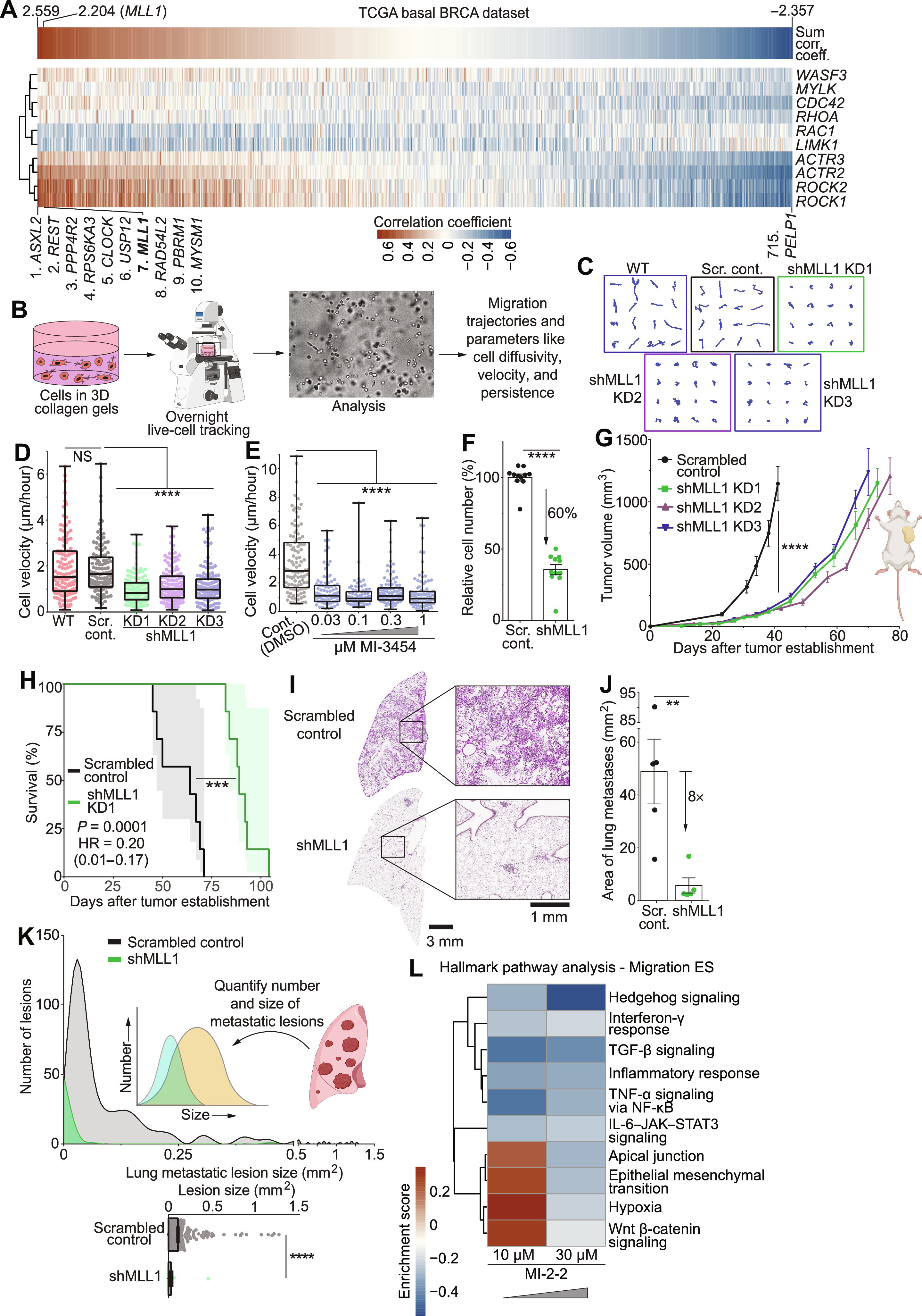 MLL1 regulates cytokine-driven cell migration and metastasis